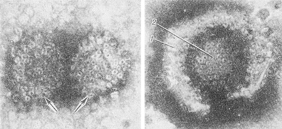 Как выглядит вирус герпеса под микроскопом фото